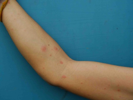 Moucheron Piqueur Bouton Dans Le Desert De Tatacoa